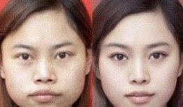 长沙整容爆料案件最新情况,真相大白，受害者权益如何保障？